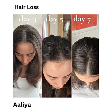 After just a few weeks, my hair feels fuller. Less hair on my brush, more confidence in me. It truly works for reducing hair fall