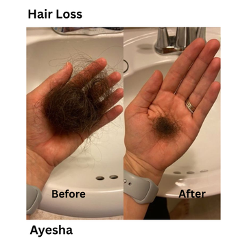 I’ve been struggling with hair fall for a while, but after using this product regularly, I noticed a big difference. My hair feels stronger, thicker, and the hair fall has reduced a lot. Highly recommend it to anyone facing hair loss.